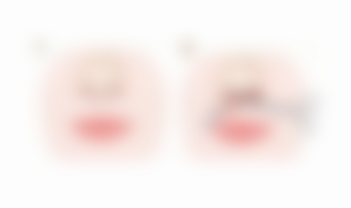 消除疤痕性痘痘有何妙招？分型定制方案，结合医美与日常护理焕新肌肤