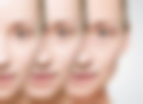 告别熊猫眼！选择合适医美项目，让你无后顾之忧