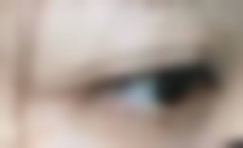 脸被手抓伤后留疤概率揭秘！正规医院多方案助您应对抓伤疤痕困扰 