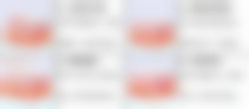 小孩缝针疤痕能否去掉？积极面对，有效去除不是梦