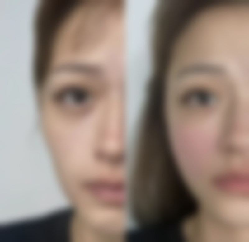 五、内江熙美蓝汇医疗美容诊所实例