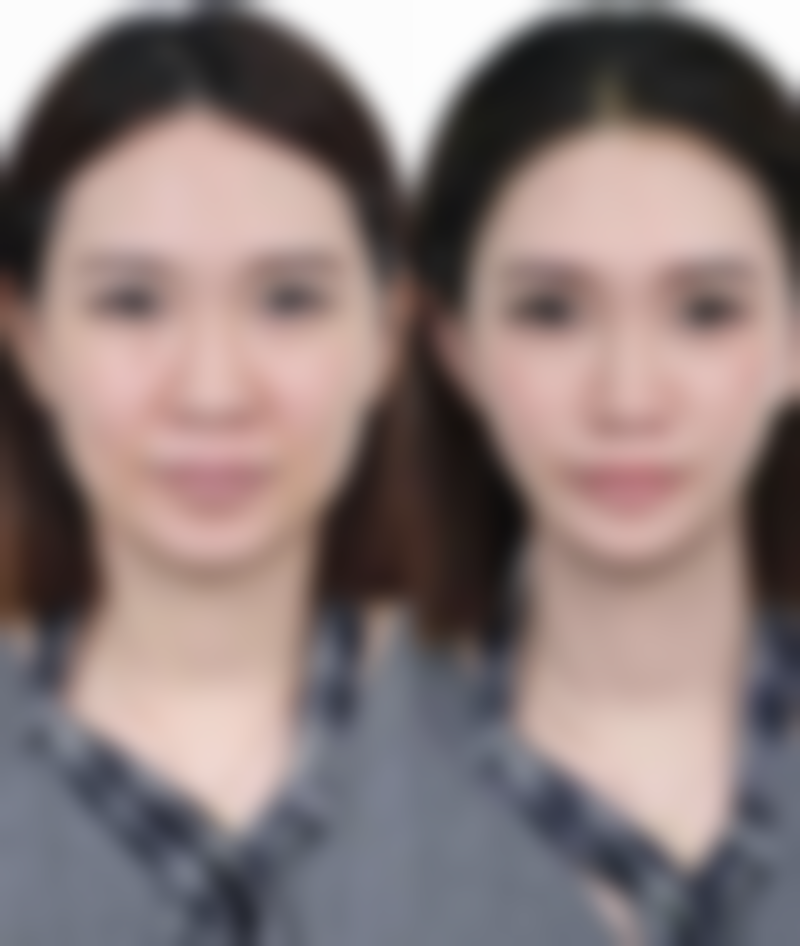 七、贵阳医学校附属医院烧伤整形外科价格表：（仅供参考）