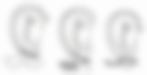 全切与三点定位术，为眼皮厚者打造专属美丽