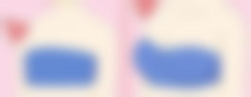 告别眼袋内油脂困扰！多种医美方案+日常护理，科学有效消除眼部脂肪 