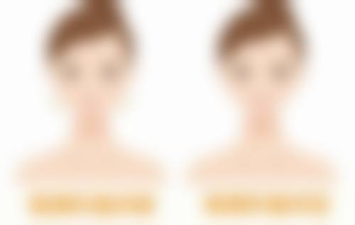 消肿时间规律：心里有数不着急