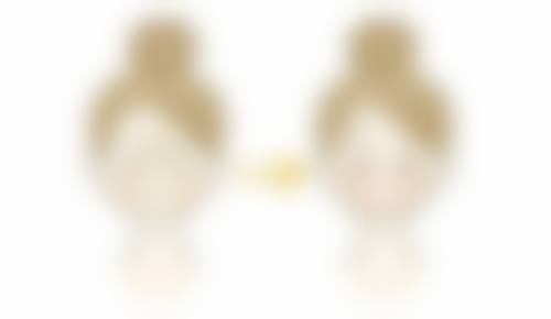 去眼袋手术注意啥？术前查身体、沟通方案，术后重护理、理性看效果 