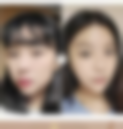 想知道如何有效去除眼袋？多种医美方案+日常护理，助你告别眼袋烦恼 