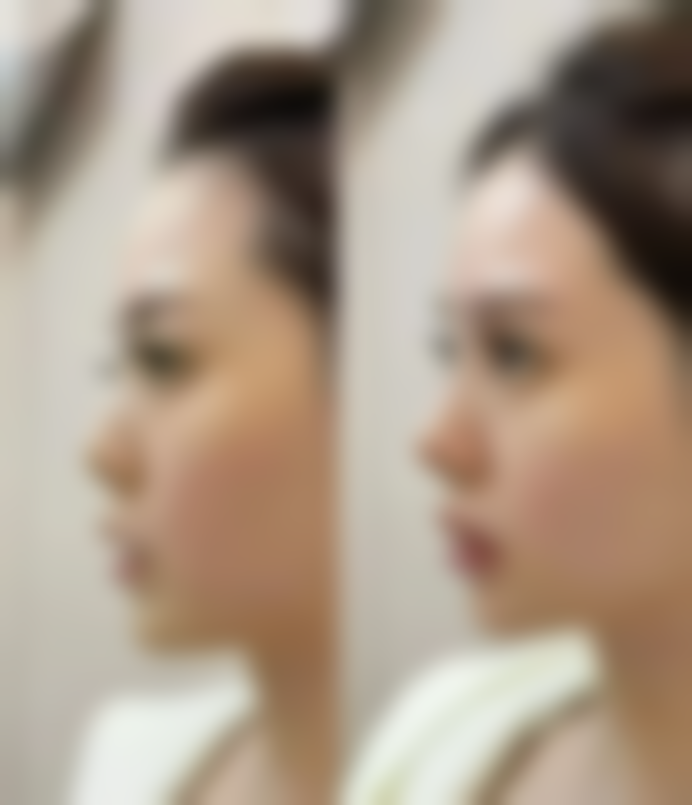 多种术式，总有一款适合你