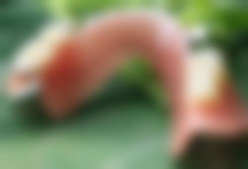 揭秘手术视觉放大双眼的多元方案