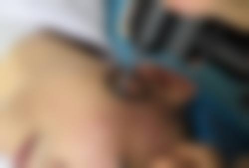 想知道用什么油去眼袋最好？薰衣草、柠檬等精油，搭配医院去眼袋项目效果更佳 