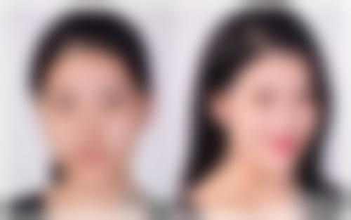 手术疤痕轻松淡化有妙招！综合疗法搭配专业医院，告别疤痕不再是梦