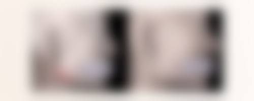 傲诺拉隆胸假体好不好？FDA+CE双认证，手感柔软饱满，还能终身相伴！ 