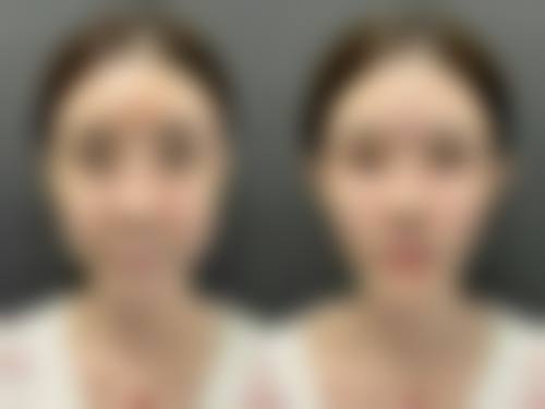 七、西安瑞美佳人医疗美容医院真实的顾客评价如下：