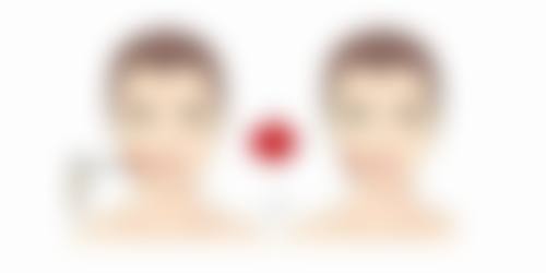 六、东莞东城非凡整形美容医院怎么预约：