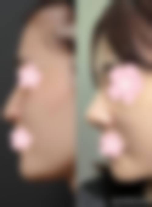 李增产项目价格表参考