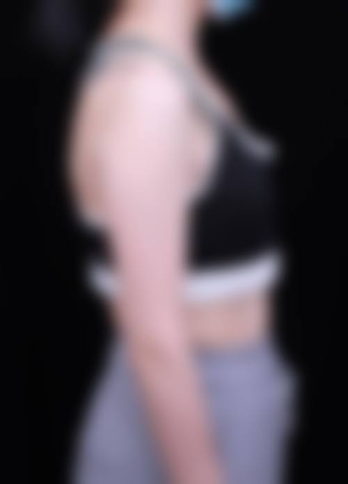 李增产项目价格表参考