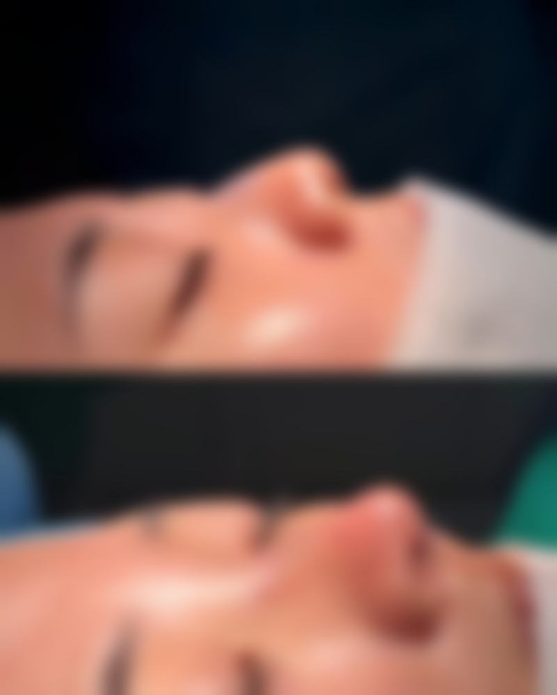 祛疤膏的种类选择