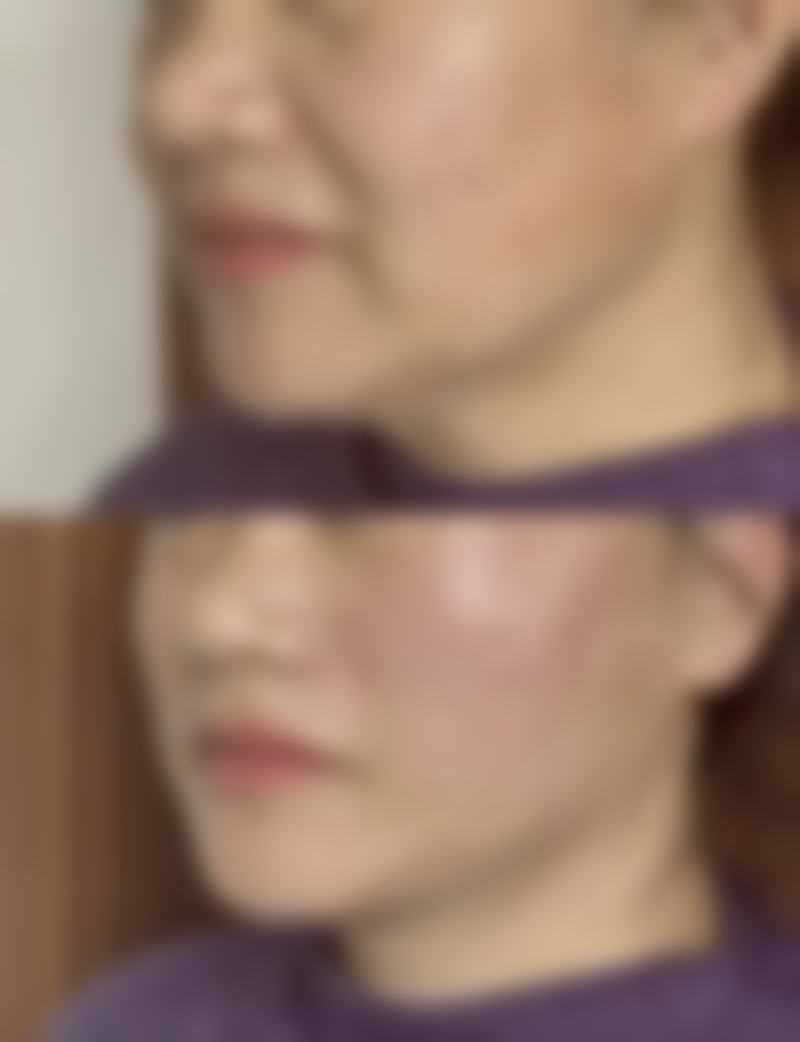 四、东莞东城非凡整形美容医院开展的主要项目和特色项目