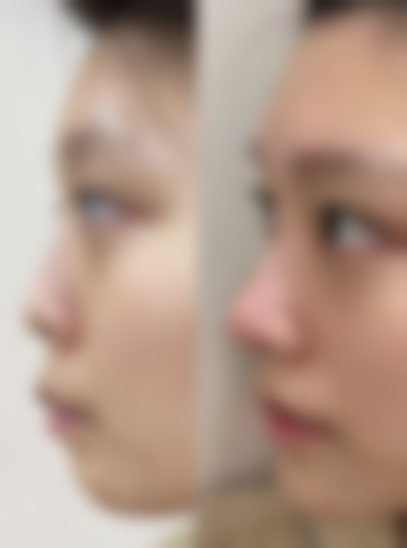 六、六盘水禾美星整形医院价格表：（仅供参考）