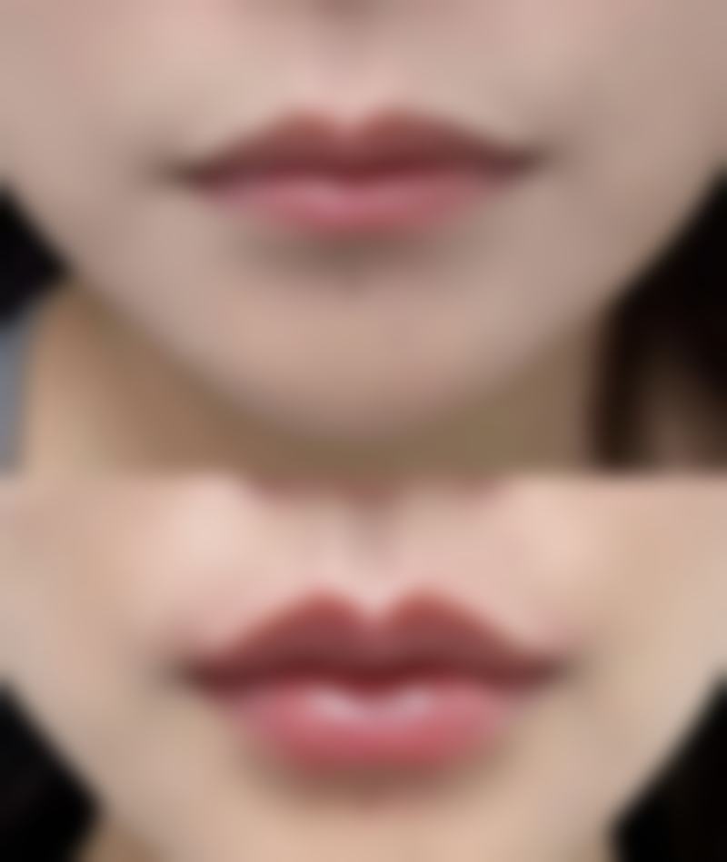 七、广州荔医整形医院价格表：（仅供参考）