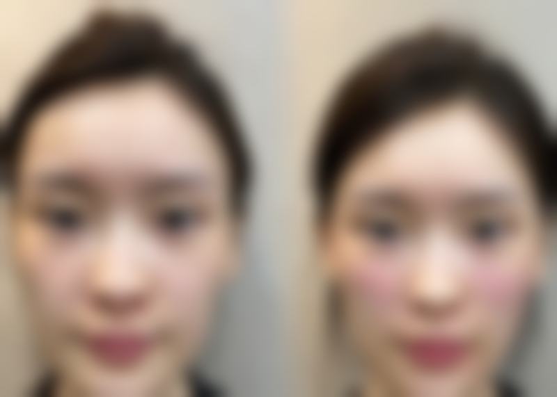 五、南宁瑞柏美医疗美容门诊部实例