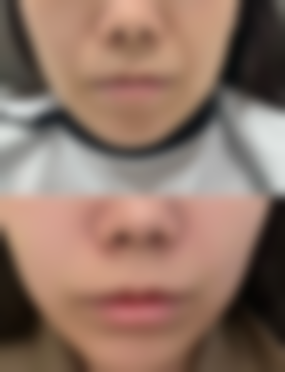 五、广州荔医整形医院实例