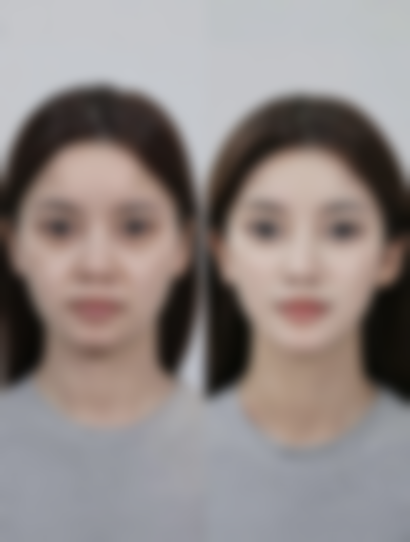 四、武汉美都医疗整形美容门诊部实例