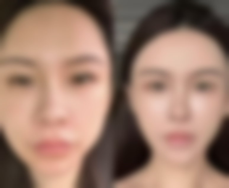 七、石家庄冀美医疗美容门诊部价格表：（仅供参考）