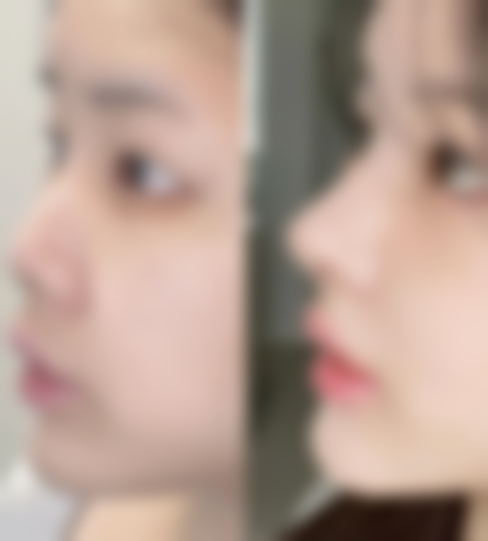 五、石家庄冀美医疗美容门诊部实例