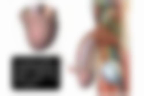 开水烫伤疤痕增生治疗之日常护理要点