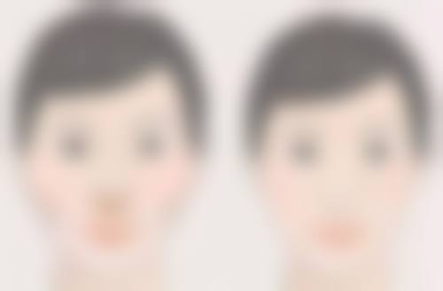 揭秘医院改善切痣疤痕的常见方法