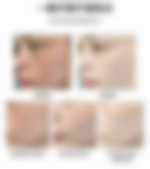 郑凤兰在哪家医院