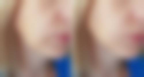 何晓雅怎么预约？