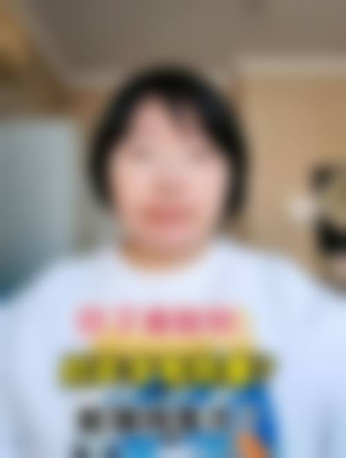 何晓雅注射除皱水平怎么样可靠吗？