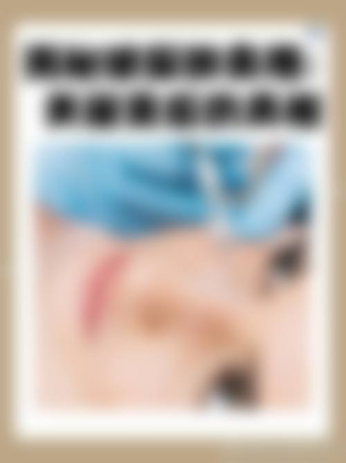 何晓雅项目价格表参考