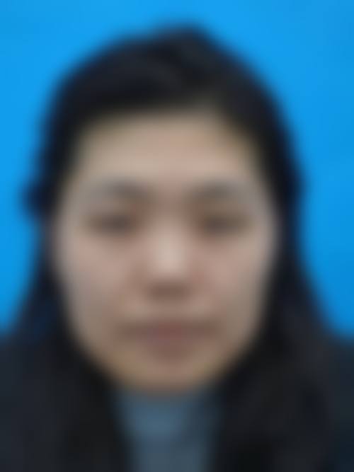 戚荣眼部整形水平怎么样可靠吗？