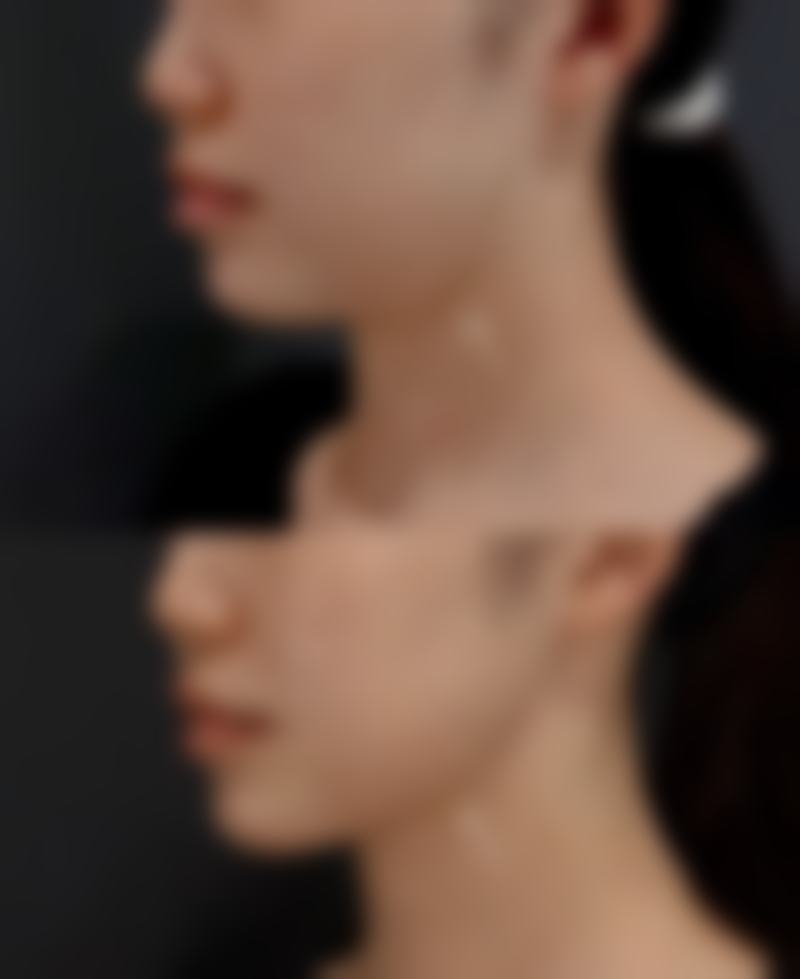 四、沈阳汇美人医疗美容先农坛路医疗美容诊所开展的项目