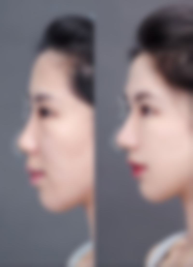 李芷焕怎么预约？