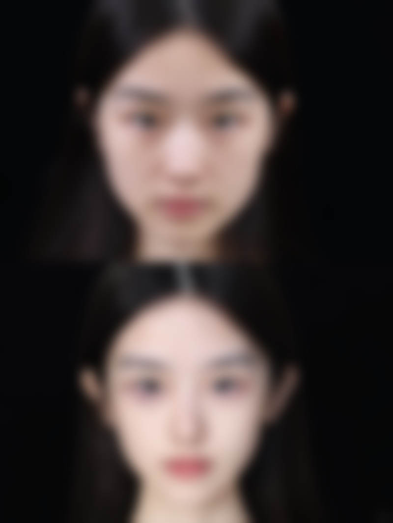 四、广东广州南方燕岭医院实例