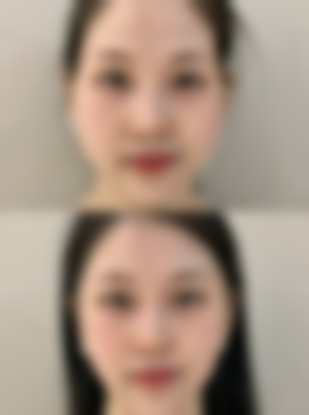 五、沈阳汇美人医疗美容先农坛路医疗美容诊所实例