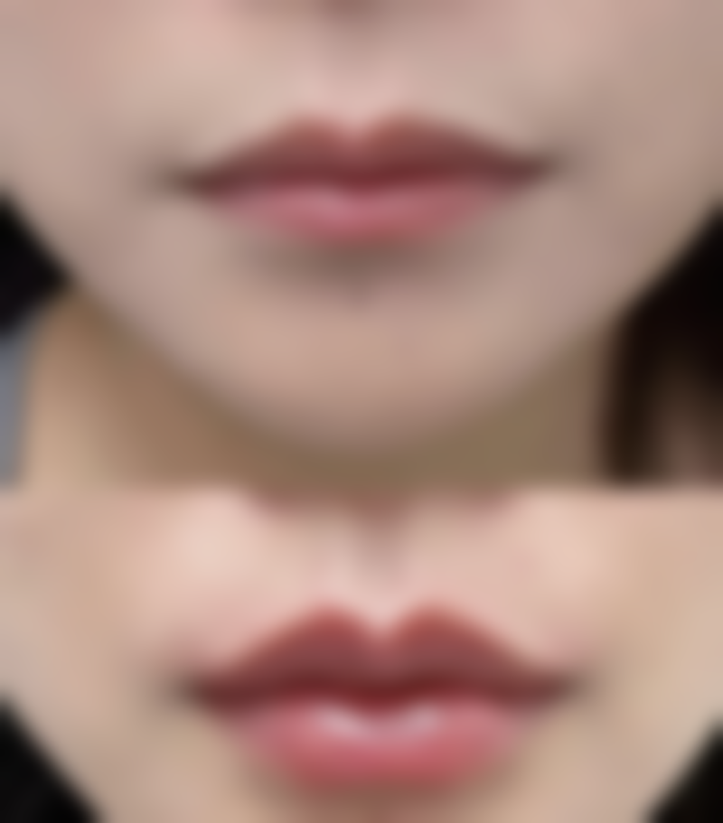 六、广东广州南方燕岭医院价格表：（仅供参考）