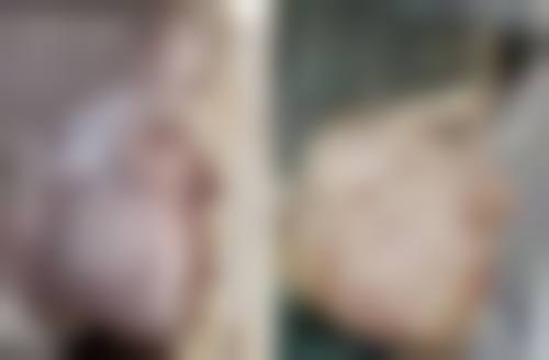 七、沈阳和平灿美医疗整形美容真实的顾客评价如下：