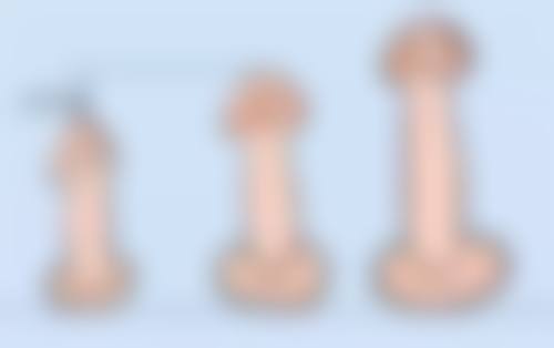 面部吸脂术值得做吗？综合优势特别突出