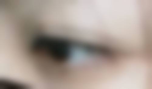 如何快速告别眼袋和黑眼圈？黑眼圈的针对性解决方案