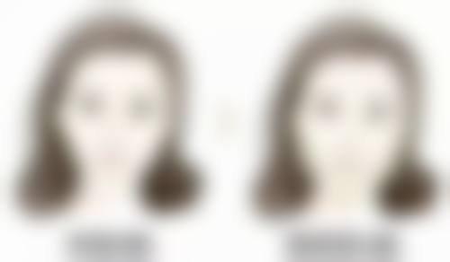 五、青岛博美医疗美容诊所怎么预约：