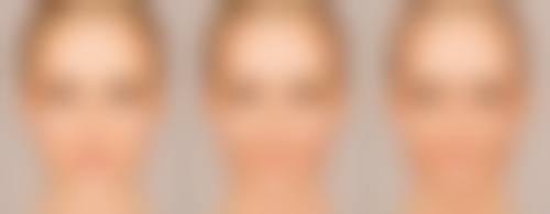 开水烫伤疤痕增生咋搞？选医院有啥门道