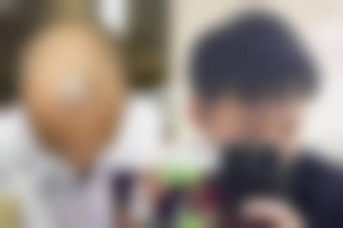 邓本文头发种植水平怎么样可靠吗？