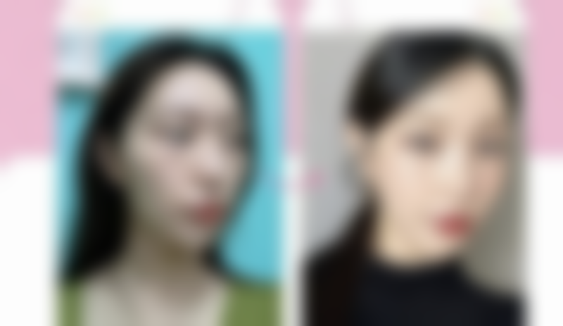 五、东莞奈瑞儿医疗美容门诊部怎么预约：