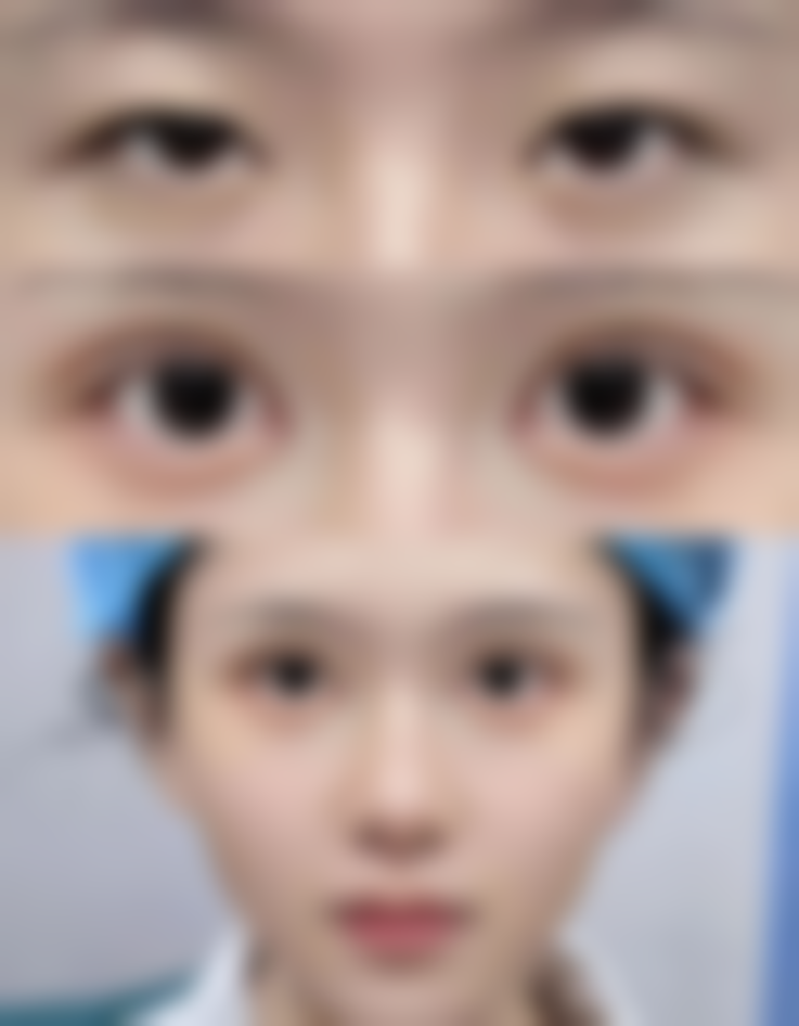 疤痕体质去除黑色素沉淀：日常护理不能少