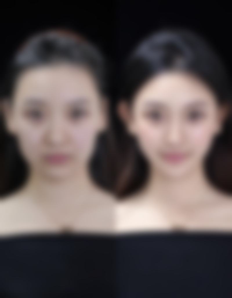 五、盐城响水莳月时光整形医院实例